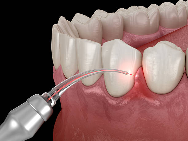 Specialist gum care and periodontal treatment